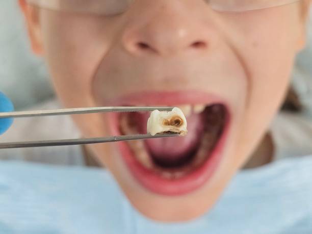Best Pediatric Emergency Dentist in Kincheloe, MI